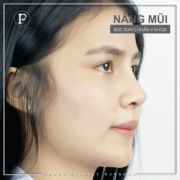 mui 10